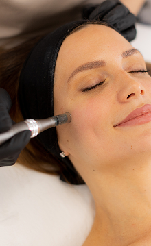 Mens IPL and Skin Needling 2