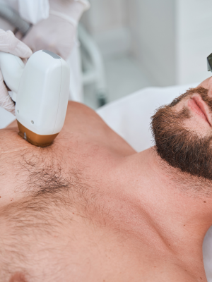 IPL Hair Removal Chest & Abdomen